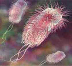 Escherichia coli infeccion