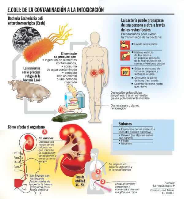 Intoxicación de Escherichia Coli