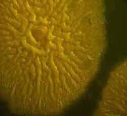 bacillus cereus