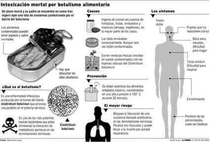 botulismo