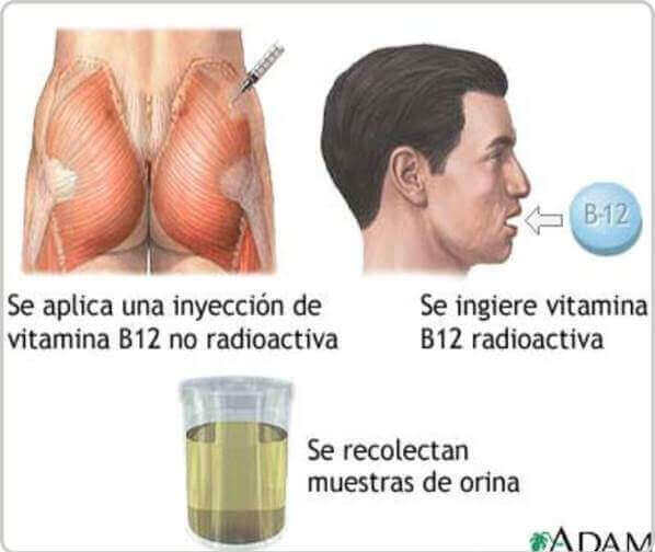 pruebas para la B12