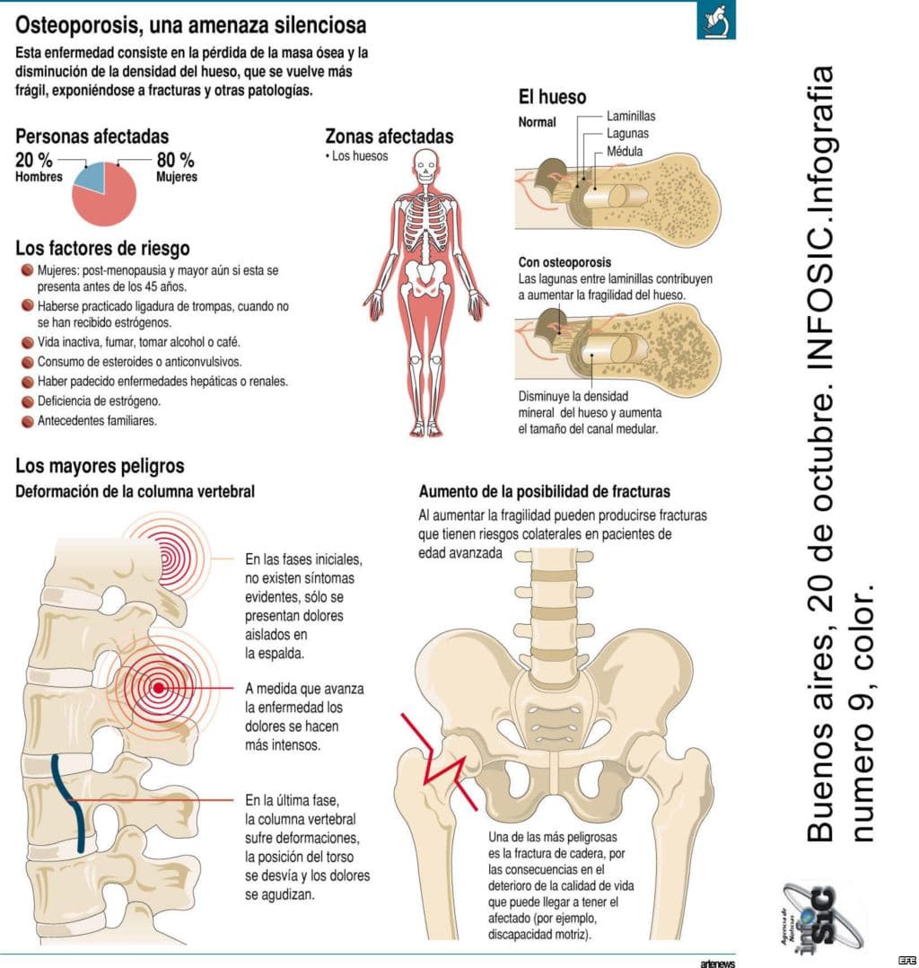 como-se-forma-una-osteoporosis