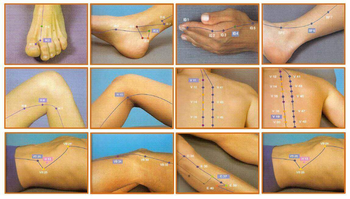 acupuntura para mejorar el parkinson