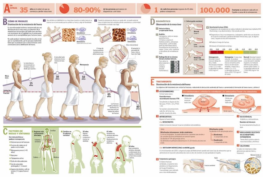 osteoporosis