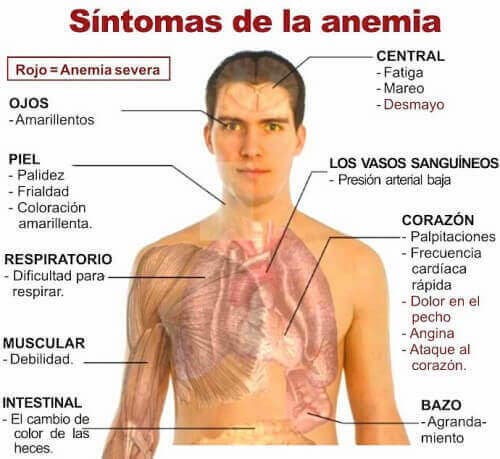 síntomas anemia