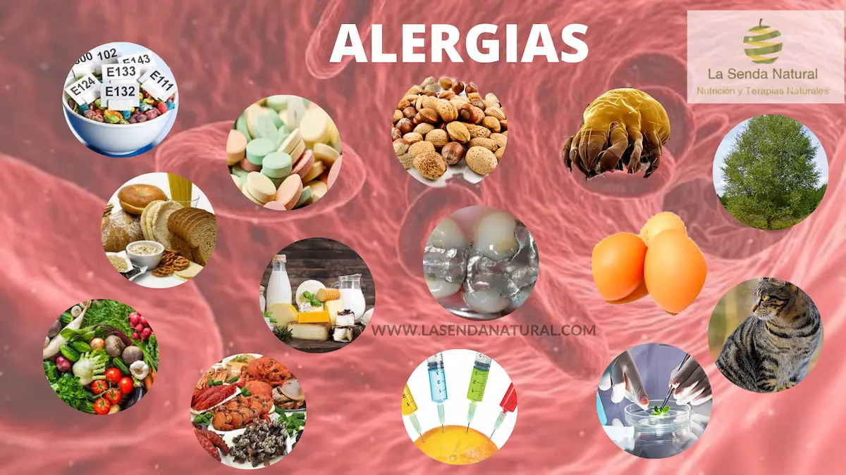 Qué son las alergias
