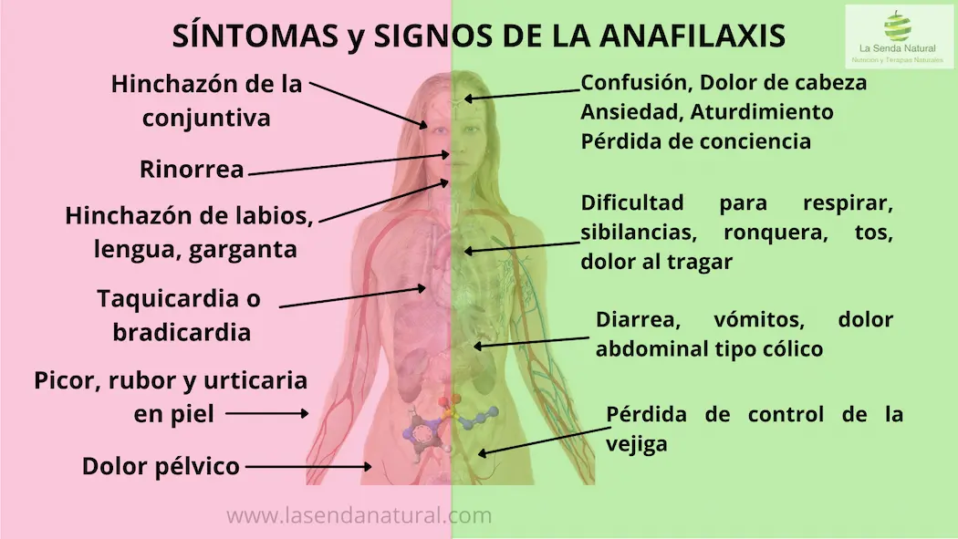 síntomas del shock anafiláctico