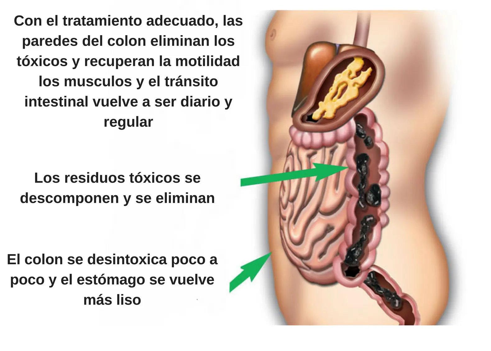 eliminar toxinas del colon