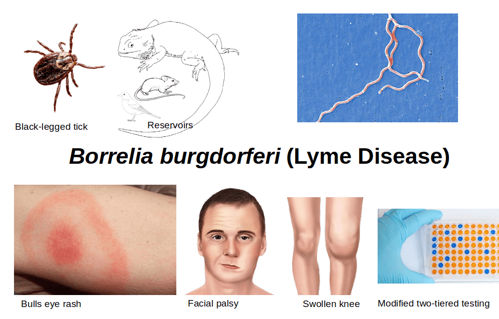 Enfermedad de Lyme