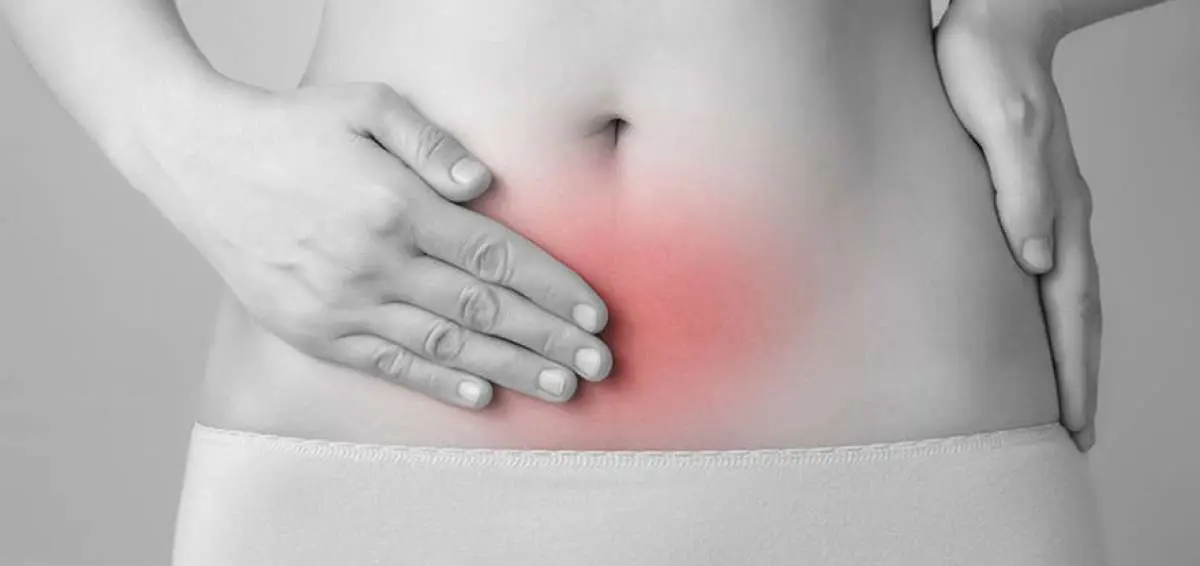 tratamiento natural de la endometriosis