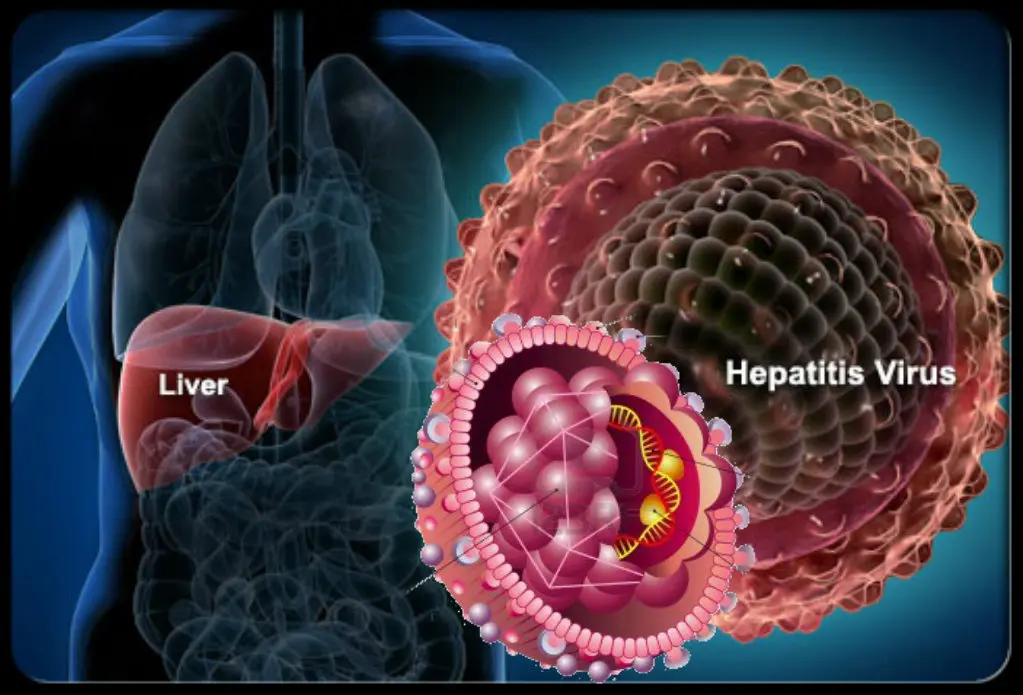 hepatitis A