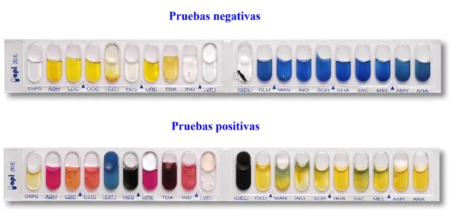 pruebas parasitos