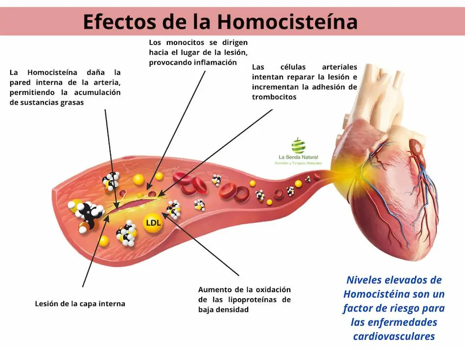 Efectos de la Homocisteína