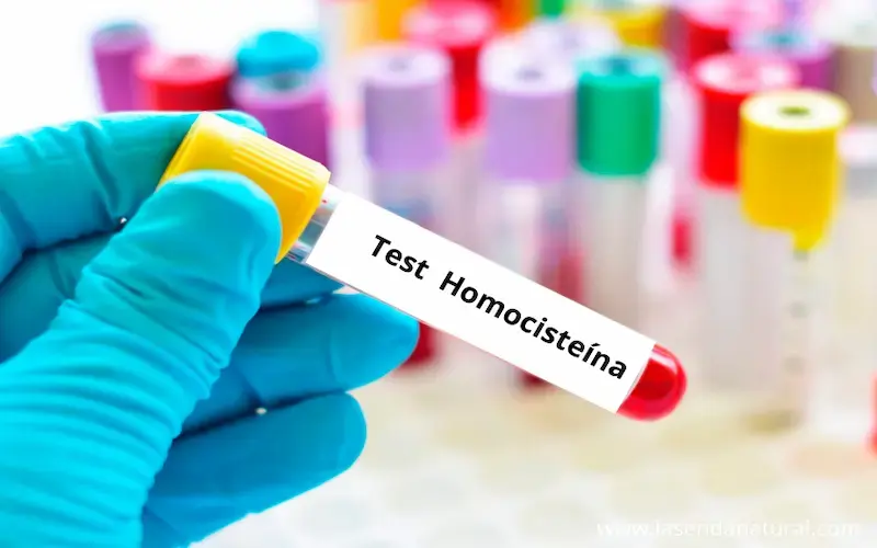 Test Homocisteína
